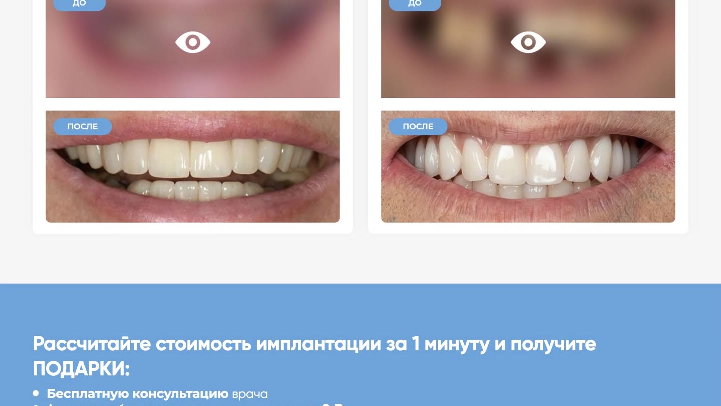 All-on-4 Новая Орбита: Разделы и содержание сайта